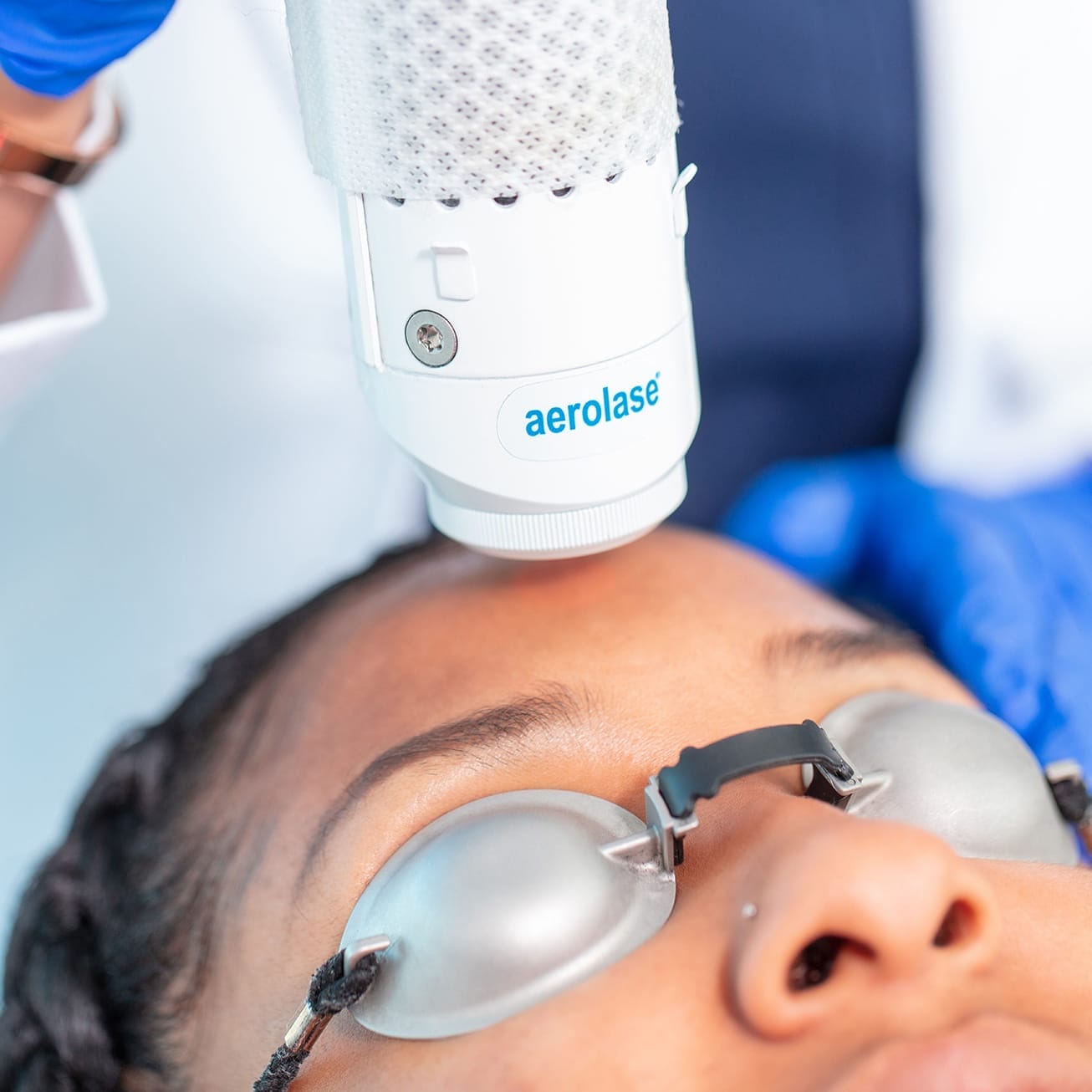 patient receiving NeoClear by Aerolase laser treatment for acne removal