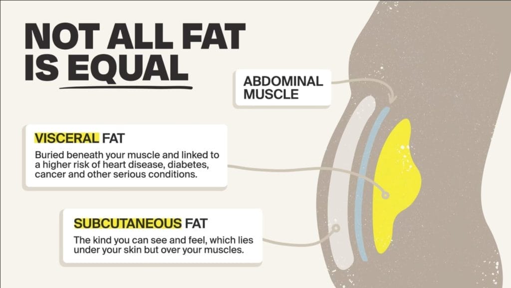 get rid of visceral fat with emsculpt neo machine